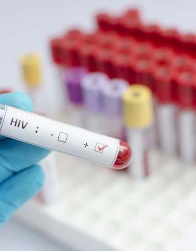 Vakalar en sık 30-34 yaşlarında görülüyor HIVin bulaşma yollarına dikkat HIVden korunma yolları