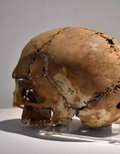 İnsan Anatomisi: Kafatası Yapıları Ve İşlevleri