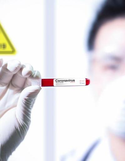 Koronavirüs çalışması bilim dünyasını ayağa kaldırdı Yüzde 100 ölümcül… “Geç olmadan durdurulmalı”