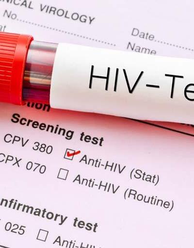 Uzmanı uyardı: HIV virüsü kanser dahil pek çok hastalığa yol açabilir