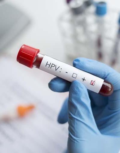 HPVnin kansere yol açan ve açmayan tipleri var