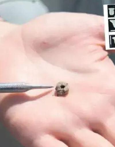 Mardinde ortaya çıktı: En az 11 bin yıllık piercing