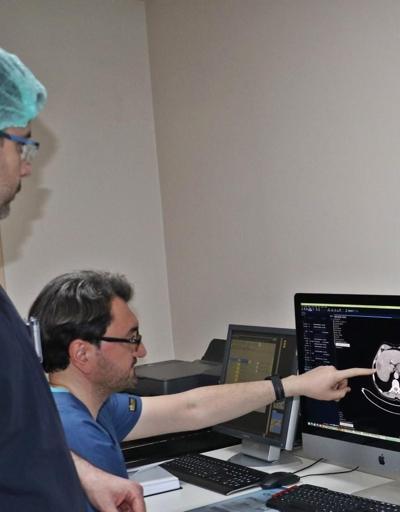 Dicle Üniversitesi’nde, Karaciğer tümörü tedavisinde radyasyon partikülü ile tümör küçültme yöntemi uygulanmaya başlandı