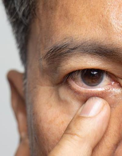 Ekran bağımlığı, göz sağlığını tehdit ediyor
