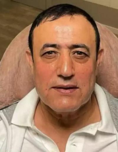 Mahmut Tuncer de estetik operasyon geçirdi