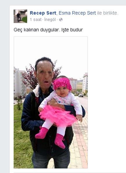 Yüz nakli olan baba kızıyla fotoğrafını paylaştı