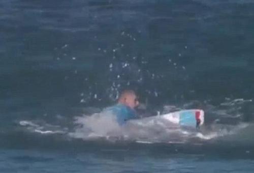 Ünlü sörfçüye köpekbalığı saldırısı