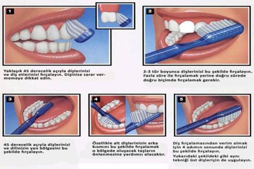 Diş beyazlatma için etkili fırçalama teknikleri
