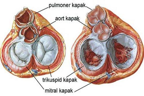 Çarpan kalpte ameliyat yaşam oranını artırıyor