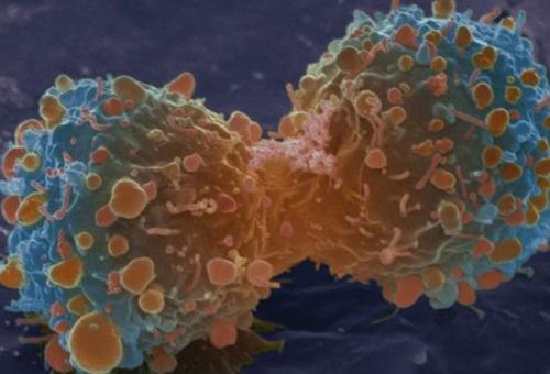 Kanser tedavisinde kemoterapi yerine hap dönemi