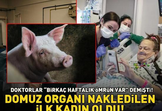 Doktorlar Birkaç haftalık ömrün var demişti Domuz organı nakledilen ilk kadın o oldu, sosyal medyayı salladı