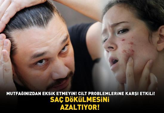 Egzama, sedef ve sivilce gibi cilt problemlerine karşı etkili Lokman Hekim asırlar önce önerdi Saç dökülmesini azaltıyor