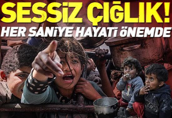İnsanlık ölüyor: Çocukların sessiz çığlığı 14 bin bebek risk altında