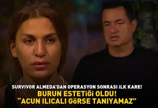 BURUN ESTETİĞİ OLDU Survivor Almeda sosyal medyayı 2ye böldü Acun Ilıcalı görse tanıyamaz