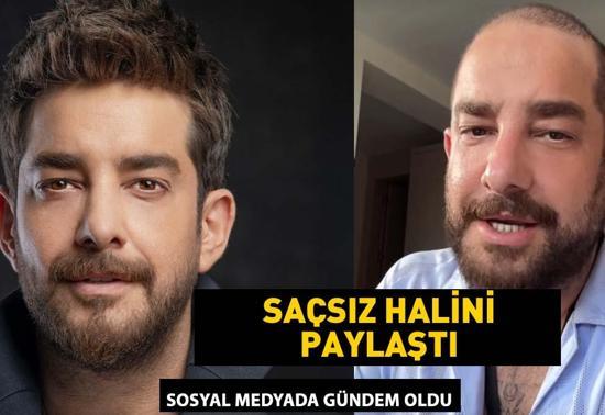 Enis Arıkanın saçsız hali gündem oldu Meğer protez saç kullanıyormuş