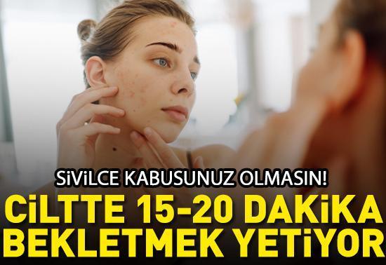 Sivilce kabusunuz olmasın