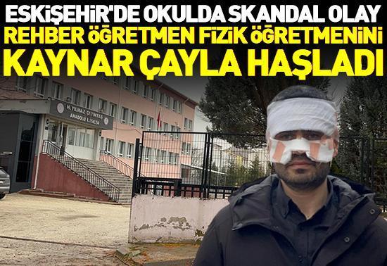 Öğretmen, meslektaşının yüzüne sıcak çay fırlattı