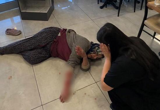 Dinlenme tesisinde dehşet! Sahipsiz köpek kolunu kopardı