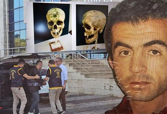 Elektronik kelepçeyi kırıp kaçmıştı! 'Kirpi Ahmet' yakalandı