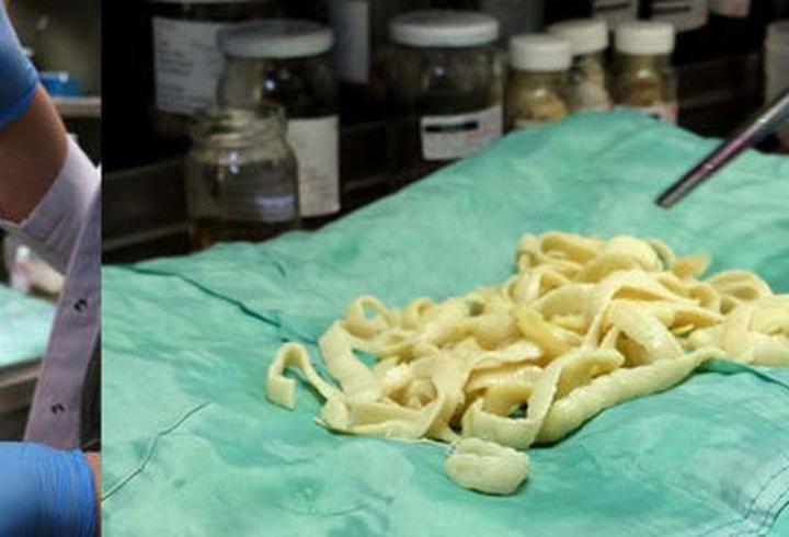 Tenya Nedir, Neden Olur? Tenya Nasıl Dökülür, Tenya Tedavisi Nasıl Yapılır?