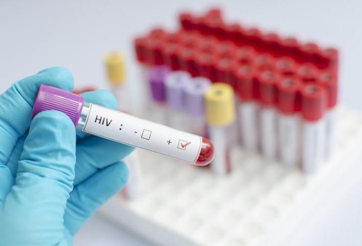İngiltere'nin konuştuğu HIV skandalı