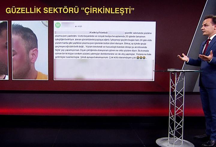 Güzellik sektöründe 2. ‘Dilan’ vakası! Yüzleri yandı...