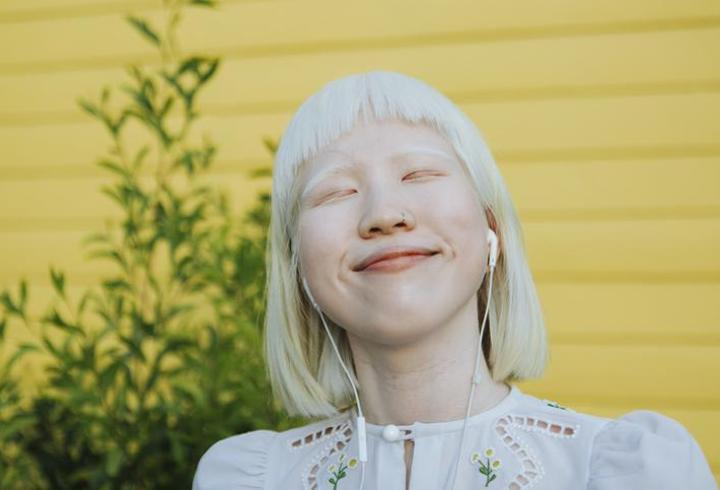 Albino Nedir, Neden Olur? Albino Tedavisi Var Mıdır?