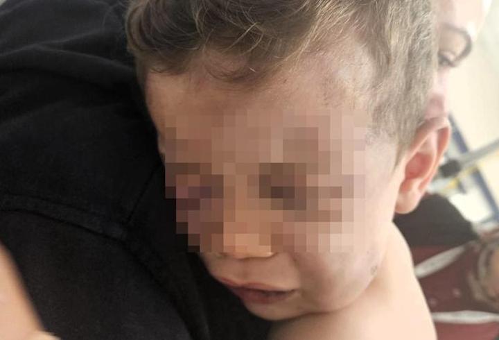 Denizli’de 2 yaşındaki bebek darp edildi! Hayati tehlikesi devam ediyor...