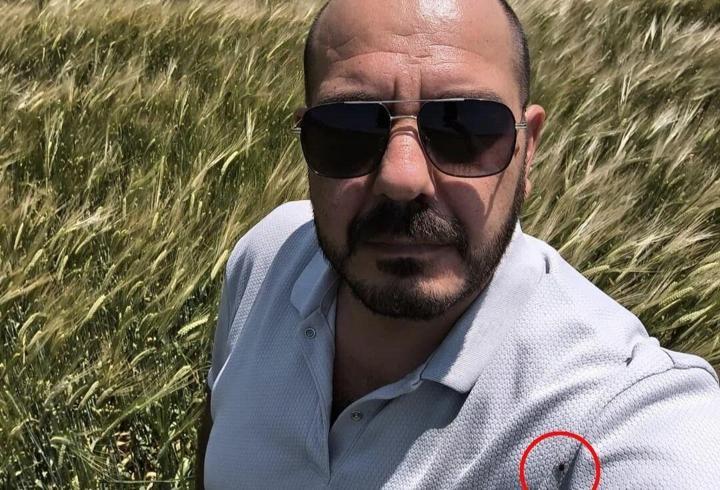 Tarlada selfi yaparken üzerinde kene olduğu fark etti