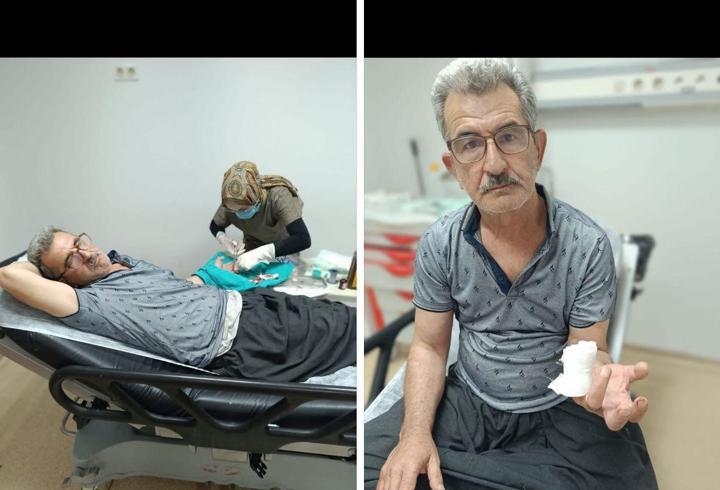 Karpuz keserken parmağını kesti
