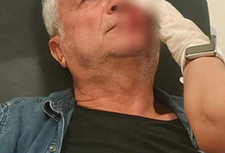 Adana’da muhtarı darbeden 3 kişi tutuklandı