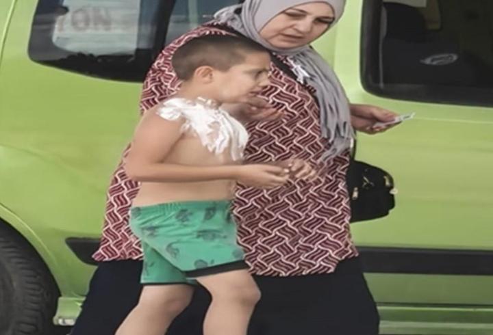 7 yaşındaki Devrim, parfüm sıkıp çakmağı ateşleyince yaralandı