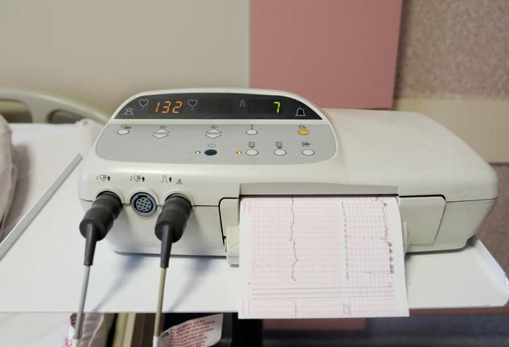 NST Nedir? NST Testi Neden Yapılır, Nelere Bakılır?