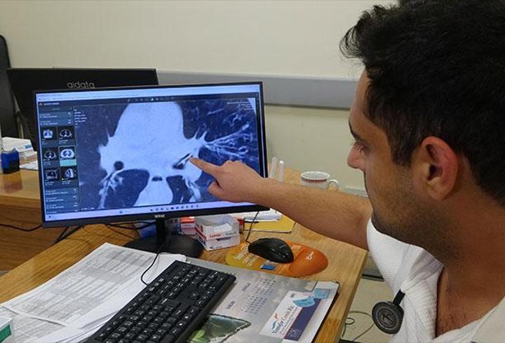 Aylarca kanser sandılar! Gerçek 'kabak çekirdeği' çıktı