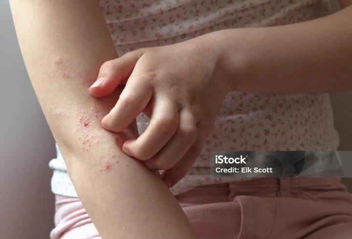 Estetik, Plastik ve Rekonstrüktif Cerrahi Uzmanı Doç. Dr. Güncel Öztürk, rinoplasti sonrası yalnızca burun şeklinin değil, yüz ifadesi, duruş, hatta psikososyal algının da nasıl değişebileceği konusunda merak edilenleri anlattı.3