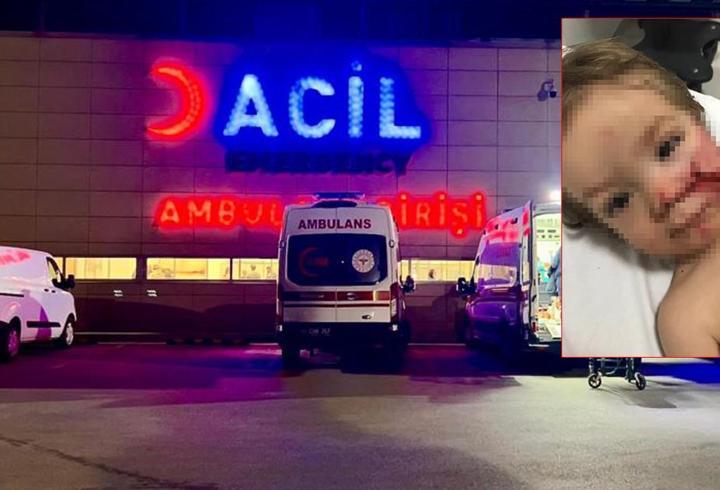 Ankara'da pitbull dehşeti: Çocuğun yüzü paramparça oldu