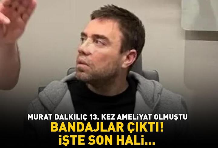 13. kez ameliyat olmuştu! Bandajlar çıktı! İşte Murat Dalkılıç'ın son hali...