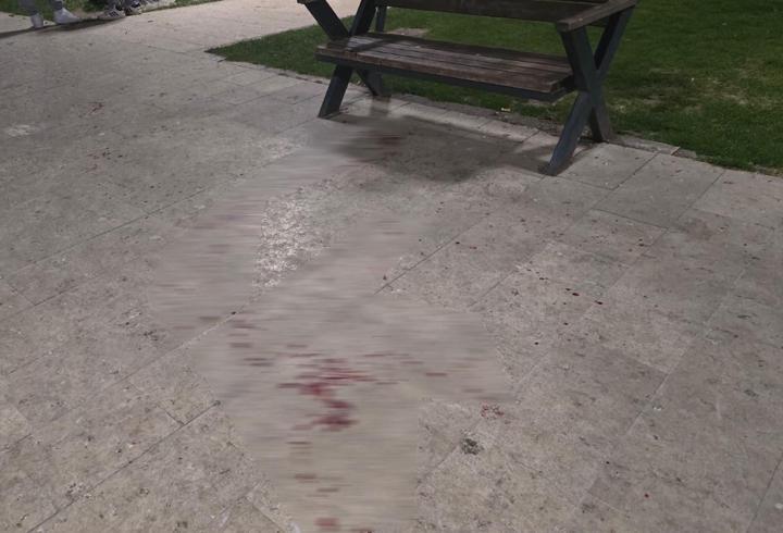 Bursa'da parkta bıçaklı kavga: 1 yaralı 