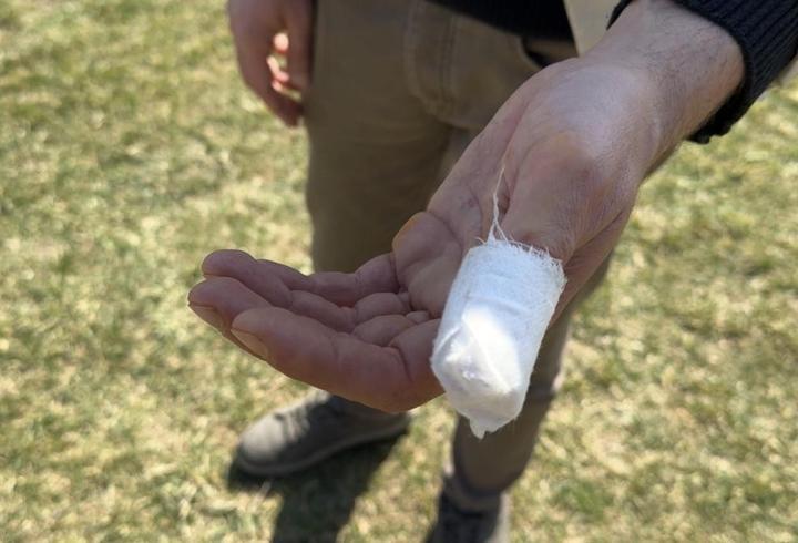 Parkta köpeği Şans ile gezerken başıboş pitbullun saldırısına uğradı