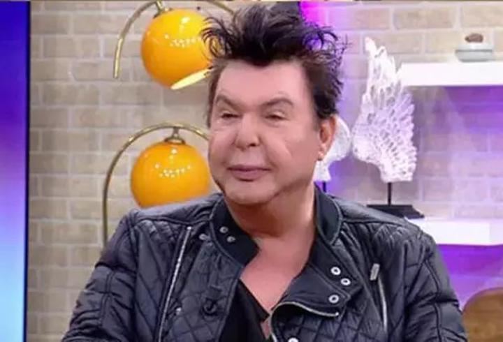 Yaptırdığı Dolgular Nedeniyle Yüzü Deforme Olmuştu! Kuşum Aydın, Bıçak Altına Yattı! İşte Ameliyat Sonrası Son Hali... Takipçileri Şaşkına Döndü