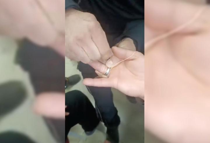 Parmağına sıkışan yüzüğü itfaiye ekipleri çıkardı