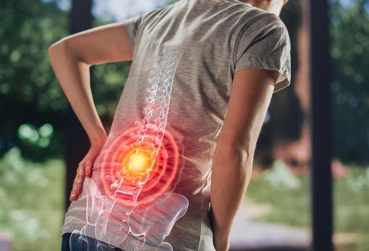 Dünyada 619 milyon insan Türkiye'de ise her 3 kişiden 1'i bel ağrısı çekiyor