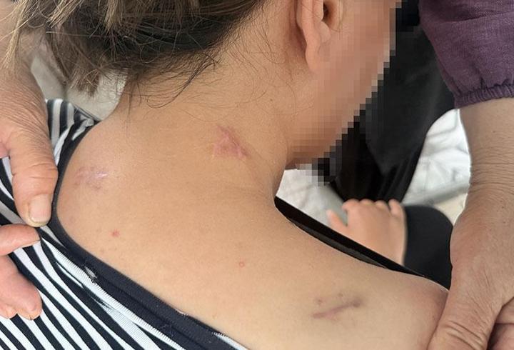 İstanbul’da kaldırımlarda motosiklet ve scooter kullanımı yasak olmasına rağmen ihlaller sürüyor. Valiliğin genelgesine rağmen birçok sürücü kurallara uymuyor. Aynı ihlali 10 kez yapanların ehliyetine el konulabiliyor. Uzmanlar, kaldırımların işgal edilmesinin yayalar için ciddi risk oluşturduğunu vurgularken, cezaların artırıldığını ve denetimlerin sıklaştırılması gerektiğini belirtiyor. Ceren Taşdelen ve Başar Günal'ın haberinde.9