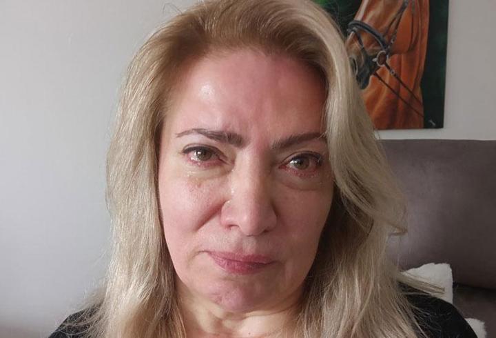 Güzellik merkezinde estetik sonrası yüz felci geçirdi