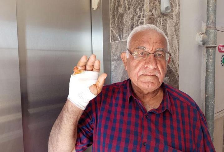 Asansörde korkunç saldırı: Komşusunun ısırdığı parmağı ampute edildi!