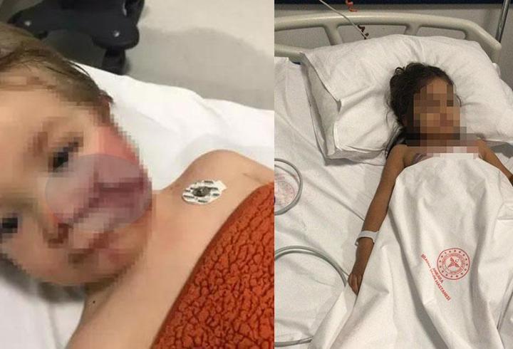 2 kardeşi yaralayan pitbullun sahibine tahliye