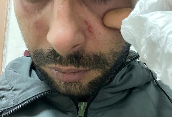 Hastaya yumruk attığı iddiasıyla doktora dava