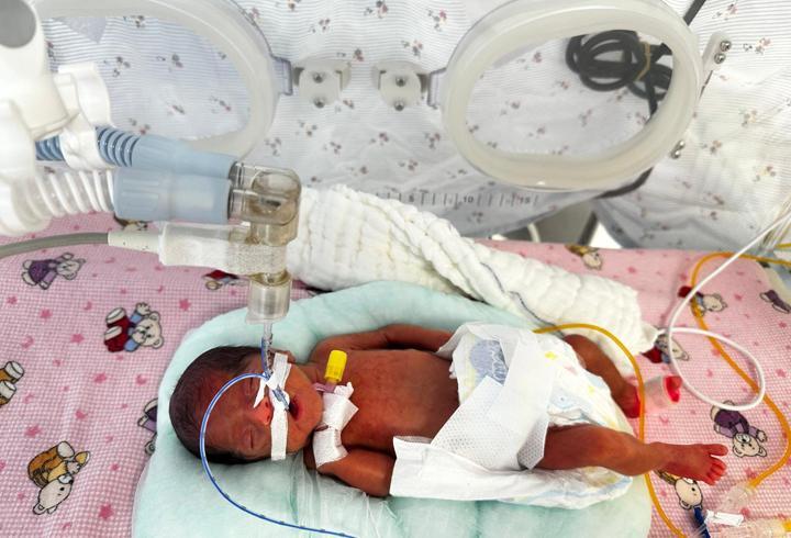 650 gramlık mucizenin adı: Leyla bebek