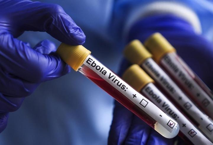 İsrail'de ilk Ebola şüphesi! Hasta karantinaya alındı