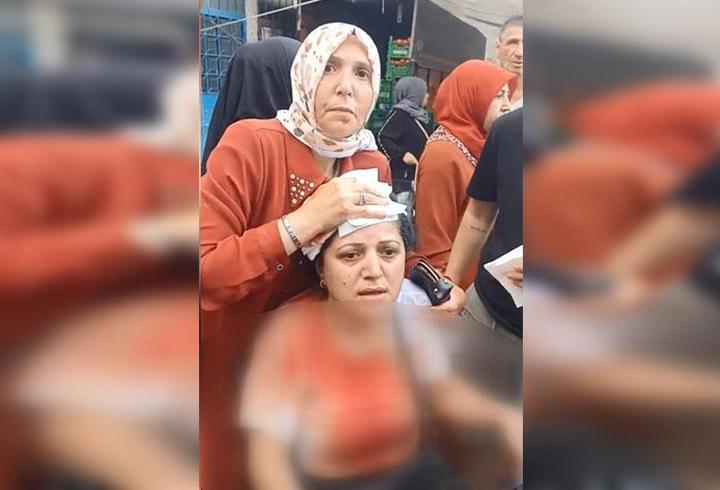 Pazarda "armut seçme" kavgası: Pazarcının kalasla yaraladığı kadının kafasına 10 dikiş atıldı